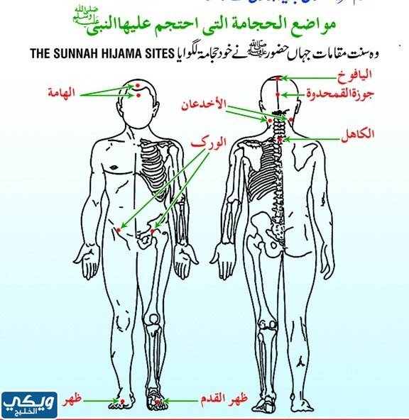 أماكن الحجامة للنساء بالصور