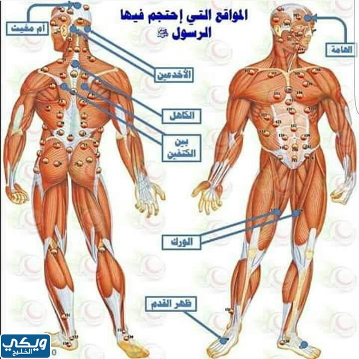 أماكن الحجامة للنساء بالصور